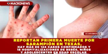 REPORTAN PRIMERA MUERTE POR SARAMPIÓN EN TEXAS, HAY MÁS DE 124 CASOS CONFIRMADOS Y 18 HOSPITALIZACIONES DE BEBÉS, NIÑOS Y ADOLESCENTES EN EDAD ESCOLAR