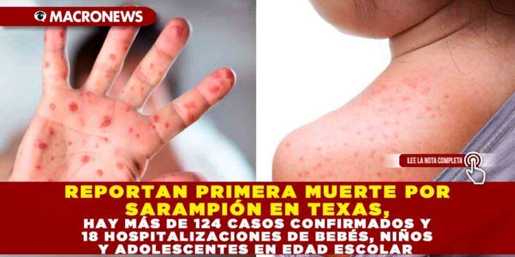 REPORTAN PRIMERA MUERTE POR SARAMPIÓN EN TEXAS, HAY MÁS DE 124 CASOS CONFIRMADOS Y 18 HOSPITALIZACIONES DE BEBÉS, NIÑOS Y ADOLESCENTES EN EDAD ESCOLAR