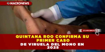 QUINTANA ROO CONFIRMA SU PRIMER CASO DE VIRUELA DEL MONO EN 2025