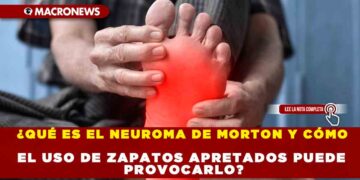 ¿QUÉ ES EL NEUROMA DE MORTON Y CÓMO EL USO DE ZAPATOS APRETADOS PUEDE PROVOCARLO?