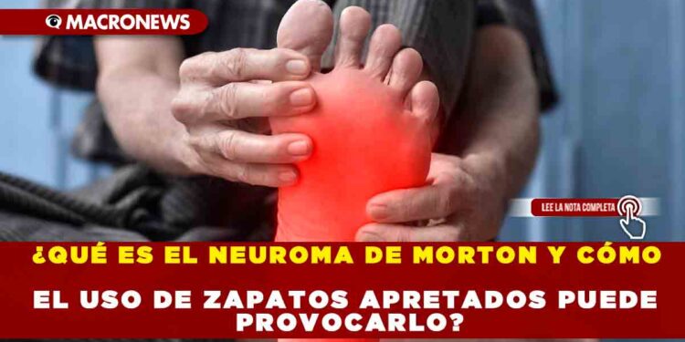 ¿QUÉ ES EL NEUROMA DE MORTON Y CÓMO EL USO DE ZAPATOS APRETADOS PUEDE PROVOCARLO?