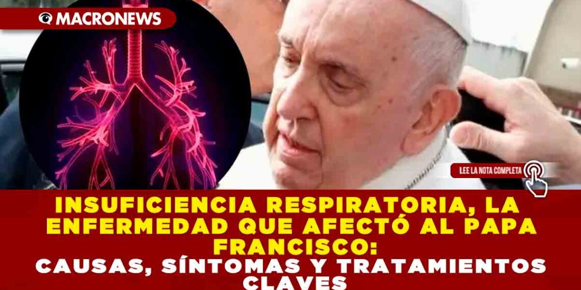 INSUFICIENCIA RESPIRATORIA, LA ENFERMEDAD QUE AFECTÓ AL PAPA FRANCISCO: CAUSAS, SÍNTOMAS Y TRATAMIENTOS CLAVES