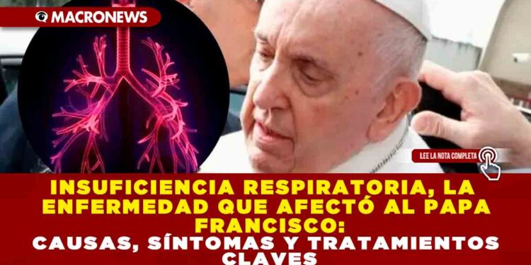 INSUFICIENCIA RESPIRATORIA, LA ENFERMEDAD QUE AFECTÓ AL PAPA FRANCISCO: CAUSAS, SÍNTOMAS Y TRATAMIENTOS CLAVES