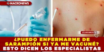 ¿PUEDO ENFERMARME DE SARAMPIÓN SI YA ME VACUNÉ? ESTO DICEN LOS ESPECIALISTAS