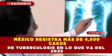 MÉXICO REGISTRA MÁS DE 4,500 CASOS DE TUBERCULOSIS EN LO QUE VA DEL 2025