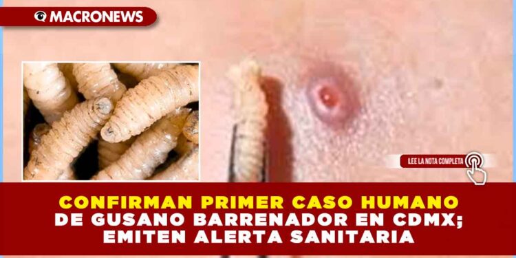 CONFIRMAN PRIMER CASO HUMANO DE GUSANO BARRENADOR EN CIUDAD DE MÉXICO; EMITEN ALERTA SANITARIA