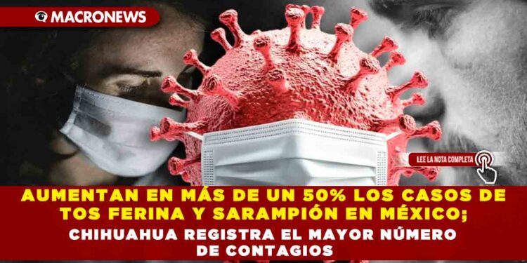 AUMENTAN EN MÁS DE UN 50% LOS CASOS DE TOS FERINA Y SARAMPIÓN EN MÉXICO; CHIHUAHUA REGISTRA EL MAYOR NÚMERO DE CONTAGIOS