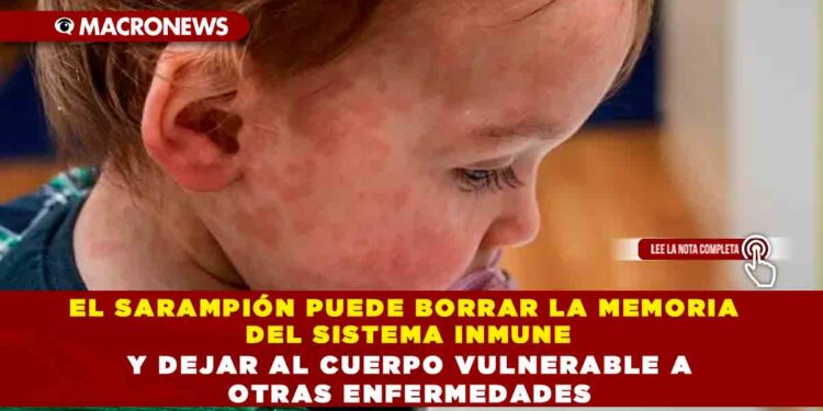 EL SARAMPIÓN PUEDE BORRAR LA MEMORIA DEL SISTEMA INMUNE Y DEJAR AL CUERPO VULNERABLE A OTRAS ENFERMEDADES