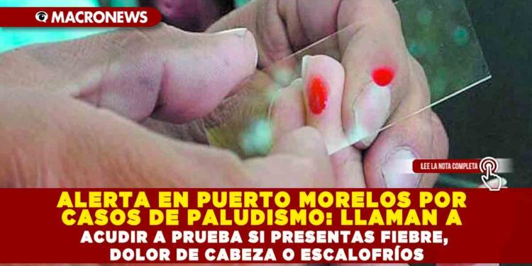 ALERTA EN PUERTO MORELOS POR CASOS DE PALUDISMO: LLAMAN A ACUDIR A PRUEBA SI PRESENTAS FIEBRE, DOLOR DE CABEZA O ESCALOFRÍOS