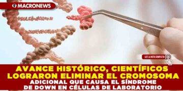 AVANCE HISTÓRICO, CIENTÍFICOS LOGRARON ELIMINAR EL CROMOSOMA ADICIONAL QUE CAUSA EL SÍNDROME DE DOWN EN CÉLULAS DE LABORATORIO