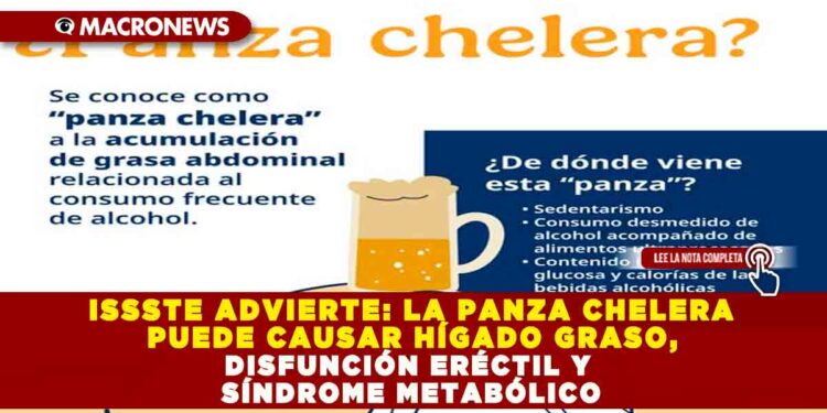 ISSSTE ADVIERTE: LA PANZA CHELERA PUEDE CAUSAR HÍGADO GRASO, DISFUNCIÓN ERÉCTIL Y SÍNDROME METABÓLICO