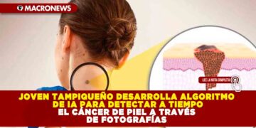 JOVEN TAMPIQUEÑO DESARROLLA ALGORITMO DE IA PARA DETECTAR A TIEMPO EL CÁNCER DE PIEL A TRAVÉS DE FOTOGRAFÍAS