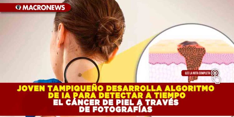 JOVEN TAMPIQUEÑO DESARROLLA ALGORITMO DE IA PARA DETECTAR A TIEMPO EL CÁNCER DE PIEL A TRAVÉS DE FOTOGRAFÍAS