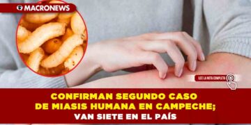 CONFIRMAN SEGUNDO CASO DE MIASIS HUMANA EN CAMPECHE; VAN SIETE EN EL PAÍS