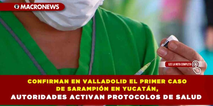 CONFIRMAN EN VALLADOLID EL PRIMER CASO DE SARAMPIÓN EN YUCATÁN, AUTORIDADES ACTIVAN PROTOCOLOS DE SALUD