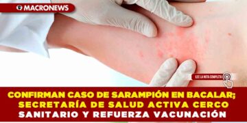 CONFIRMAN PRIMER CASO DE SARAMPIÓN EN BACALAR; SECRETARÍA DE SALUD ACTIVA CERCO SANITARIO Y REFUERZA VACUNACIÓN EN QUINTANA ROO PARA EVITAR BROTE