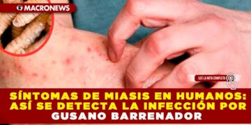 SÍNTOMAS DE MIASIS EN HUMANOS: ASÍ SE DETECTA LA INFECCIÓN POR GUSANO BARRENADOR