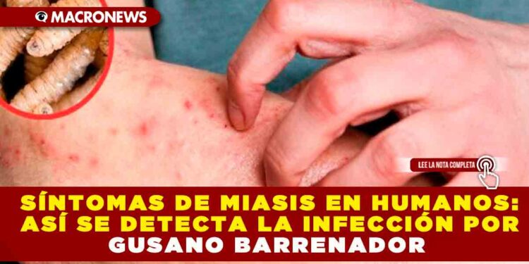 SÍNTOMAS DE MIASIS EN HUMANOS: ASÍ SE DETECTA LA INFECCIÓN POR GUSANO BARRENADOR