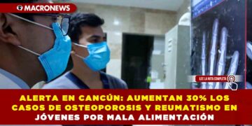 ALERTA EN CANCÚN: AUMENTAN 30% LOS CASOS DE OSTEOPOROSIS Y REUMATISMO EN JÓVENES POR MALA ALIMENTACIÓN