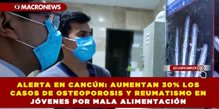 ALERTA EN CANCÚN: AUMENTAN 30% LOS CASOS DE OSTEOPOROSIS Y REUMATISMO EN JÓVENES POR MALA ALIMENTACIÓN