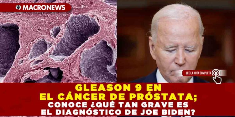 GLEASON 9 EN EL CÁNCER DE PRÓSTATA; CONOCE ¿QUÉ TAN GRAVE ES EL DIAGNÓSTICO DE JOE BIDEN?