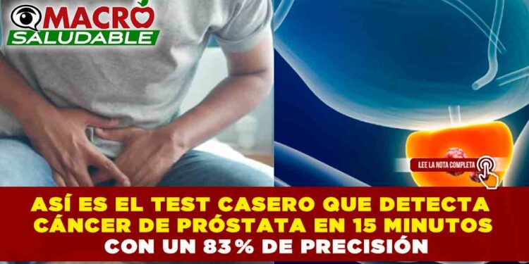 ASÍ ES EL TEST CASERO QUE DETECTA CÁNCER DE PRÓSTATA EN 15 MINUTOS CON UN 83 % DE PRECISIÓN