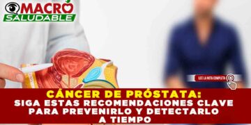 CÁNCER DE PRÓSTATA: SIGA ESTAS RECOMENDACIONES CLAVE PARA PREVENIRLO Y DETECTARLO A TIEMPO