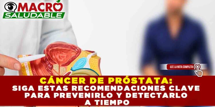 CÁNCER DE PRÓSTATA: SIGA ESTAS RECOMENDACIONES CLAVE PARA PREVENIRLO Y DETECTARLO A TIEMPO