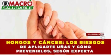 HONGOS Y CÁNCER: LOS RIESGOS DE APLICARTE UÑAS Y CÓMO PREVENIRLOS, SEGÚN EXPERTA