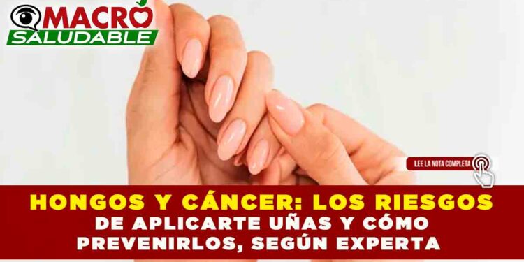 HONGOS Y CÁNCER: LOS RIESGOS DE APLICARTE UÑAS Y CÓMO PREVENIRLOS, SEGÚN EXPERTA