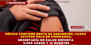 MÉXICO CONTIENE BROTE DE SARAMPIÓN, CASOS ACTIVOS SOLO EN CHIHUAHUA; SECRETARÍA DE SALUD REPORTA 3,500 CASOS Y 12 MUERTES