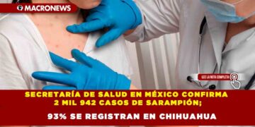 SECRETARÍA DE SALUD EN MÉXICO CONFIRMA 2 MIL 942 CASOS DE SARAMPIÓN; 93% SE REGISTRAN EN CHIHUAHUA