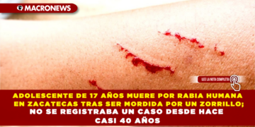 ADOLESCENTE DE 17 AÑOS MUERE POR RABIA HUMANA EN ZACATECAS TRAS SER MORDIDA POR UN ZORRILLO; NO HABÍA CASOS DESDE HACE CASI 40 AÑOS