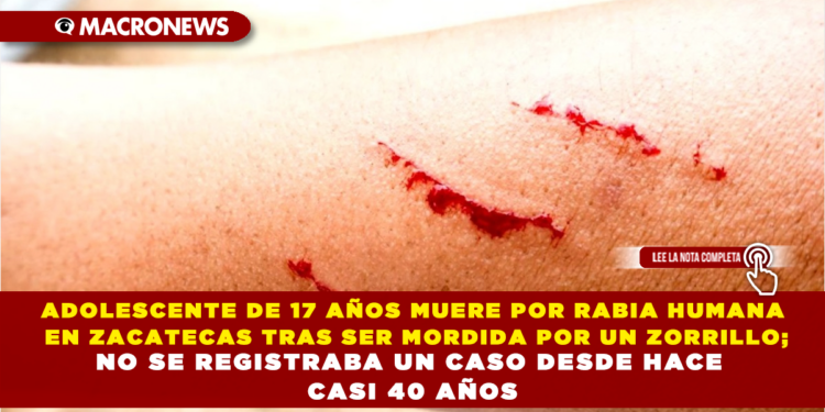 ADOLESCENTE DE 17 AÑOS MUERE POR RABIA HUMANA EN ZACATECAS TRAS SER MORDIDA POR UN ZORRILLO; NO HABÍA CASOS DESDE HACE CASI 40 AÑOS