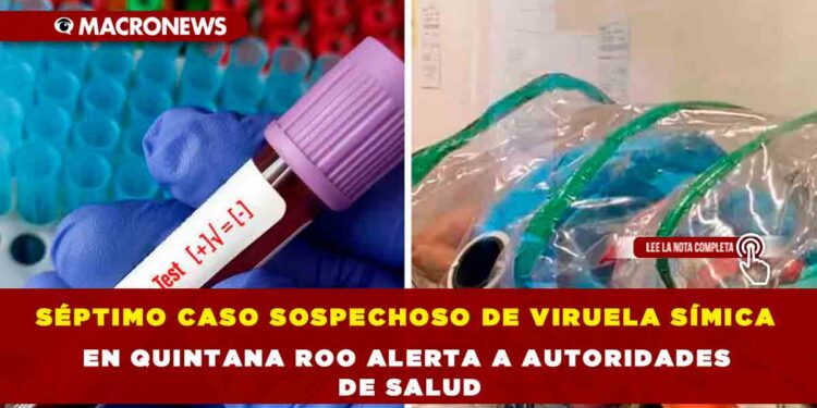 SÉPTIMO CASO SOSPECHOSO DE VIRUELA SÍMICA EN QUINTANA ROO ALERTA A AUTORIDADES DE SALUD