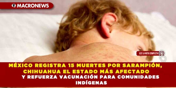 MÉXICO REGISTRA 15 MUERTES POR SARAMPIÓN, CHIHUAHUA EL ESTADO MÁS AFECTADO Y REFUERZA VACUNACIÓN PARA COMUNIDADES INDÍGENAS
