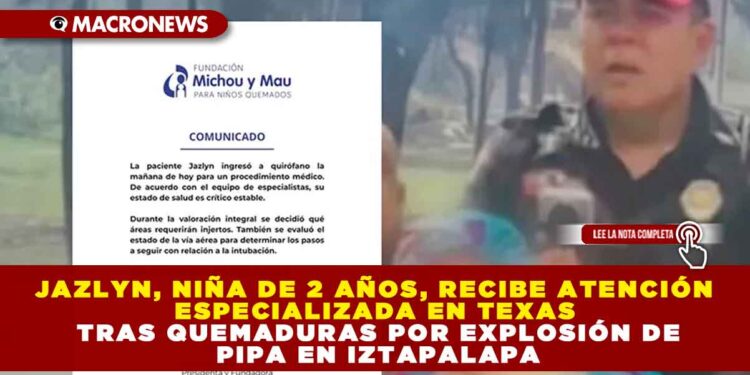 JAZLYN, NIÑA DE 2 AÑOS, RECIBE ATENCIÓN ESPECIALIZADA EN TEXAS TRAS QUEMADURAS POR EXPLOSIÓN DE PIPA EN IZTAPALAPA