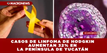 CASOS DE LINFOMA DE HODGKIN AUMENTAN 32% EN LA PENÍNSULA DE YUCATÁN EL INCREMENTO MÁS FUERTE SE REGISTRÓ EN YUCATÁN, CON 41 CASOS REPORTADOS EN 2025