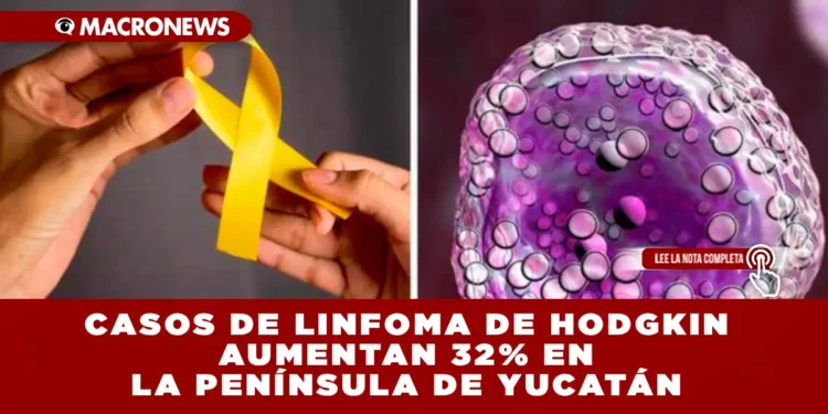 CASOS DE LINFOMA DE HODGKIN AUMENTAN 32% EN LA PENÍNSULA DE YUCATÁN EL INCREMENTO MÁS FUERTE SE REGISTRÓ EN YUCATÁN, CON 41 CASOS REPORTADOS EN 2025