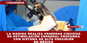LA MARINA REALIZA PRIMERAS CIRUGÍAS DE ESTIMULACIÓN CEREBRAL PROFUNDA CON SISTEMA DE ALTA PRECISIÓN EN MÉXICO