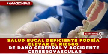 SALUD BUCAL DEFICIENTE PODRÍA ELEVAR EL RIESGO DE DAÑO CEREBRAL Y ACCIDENTE CEREBROVASCULAR