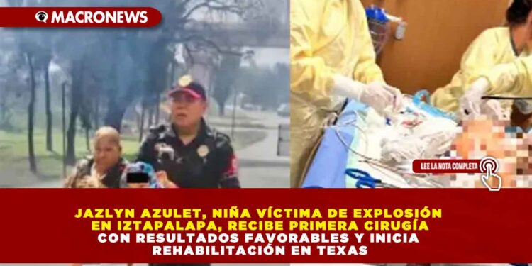 JAZLYN AZULET, NIÑA VÍCTIMA DE EXPLOSIÓN EN IZTAPALAPA, RECIBE PRIMERA CIRUGÍA CON RESULTADOS FAVORABLES Y INICIA REHABILITACIÓN EN TEXAS