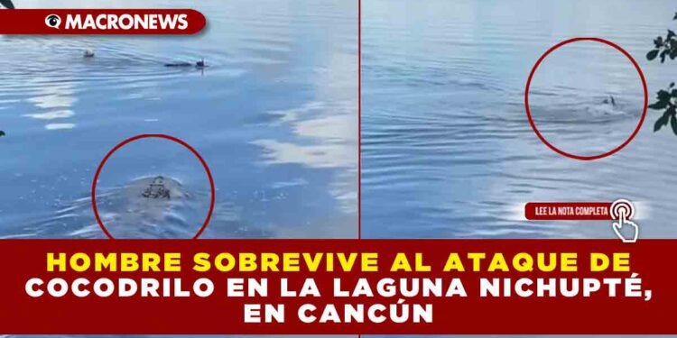 HOMBRE SOBREVIVE AL ATAQUE DE COCODRILO EN  LA LAGUNA NICHUPTÉ, EN CANCÚN