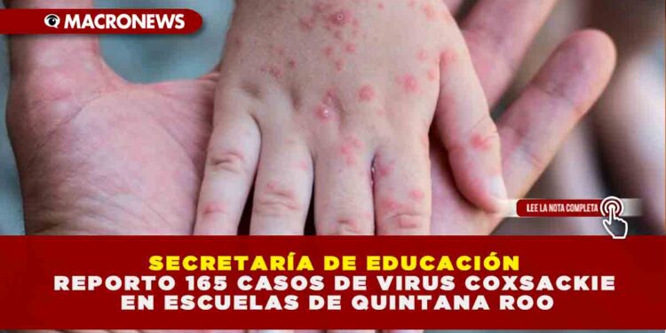 SECRETARÍA DE EDUCACIÓN REPORTO 165 CASOS DE VIRUS COXSACKIE EN ESCUELAS DE QUINTANA ROO