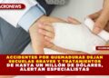 ACCIDENTES POR QUEMADURAS DEJAN SECUELAS GRAVES Y TRATAMIENTOS DE HASTA UN MILLÓN DE DÓLARES, ALERTAN ESPECIALISTAS