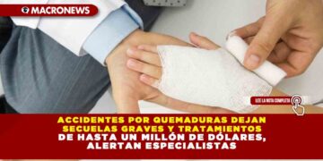 ACCIDENTES POR QUEMADURAS DEJAN SECUELAS GRAVES Y TRATAMIENTOS DE HASTA UN MILLÓN DE DÓLARES, ALERTAN ESPECIALISTAS