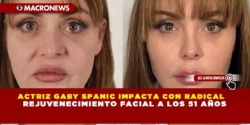 ACTRIZ GABY SPANIC IMPACTA CON RADICAL REJUVENECIMIENTO FACIAL A LOS 51 AÑOS