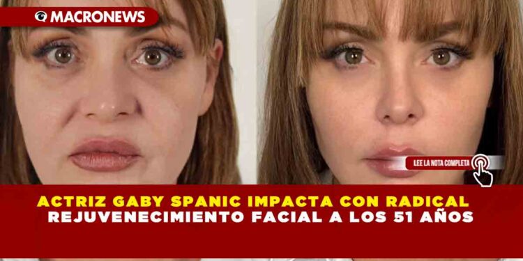 ACTRIZ GABY SPANIC IMPACTA CON RADICAL REJUVENECIMIENTO FACIAL A LOS 51 AÑOS