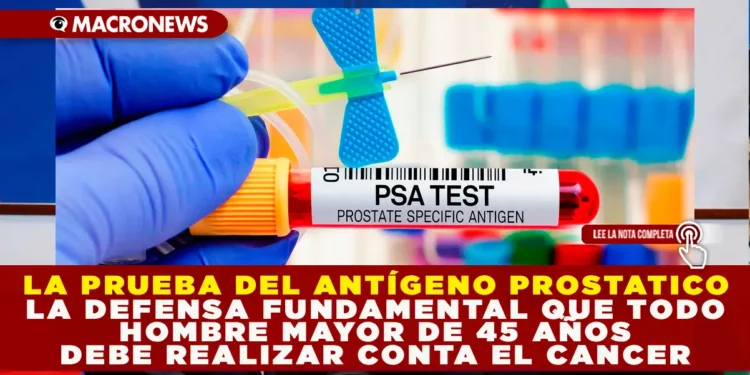 LA PRUEBA DE ANTÍGENO PROSTÁTICO: LA DEFENSA FUNDAMENTAL QUE TODO HOMBRE MAYOR DE 45 AÑOS DEBE REALIZAR CONTRA EL CÁNCER