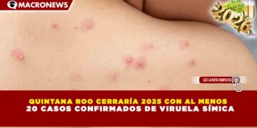 QUINTANA ROO CERRARÍA 2025 CON AL MENOS 20 CASOS CONFIRMADOS DE VIRUELA SÍMICA